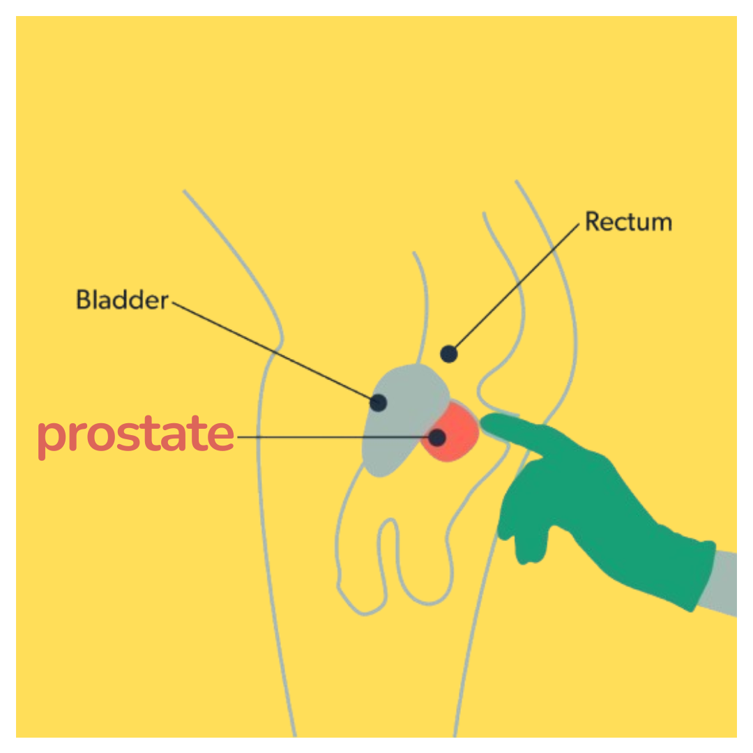prostate