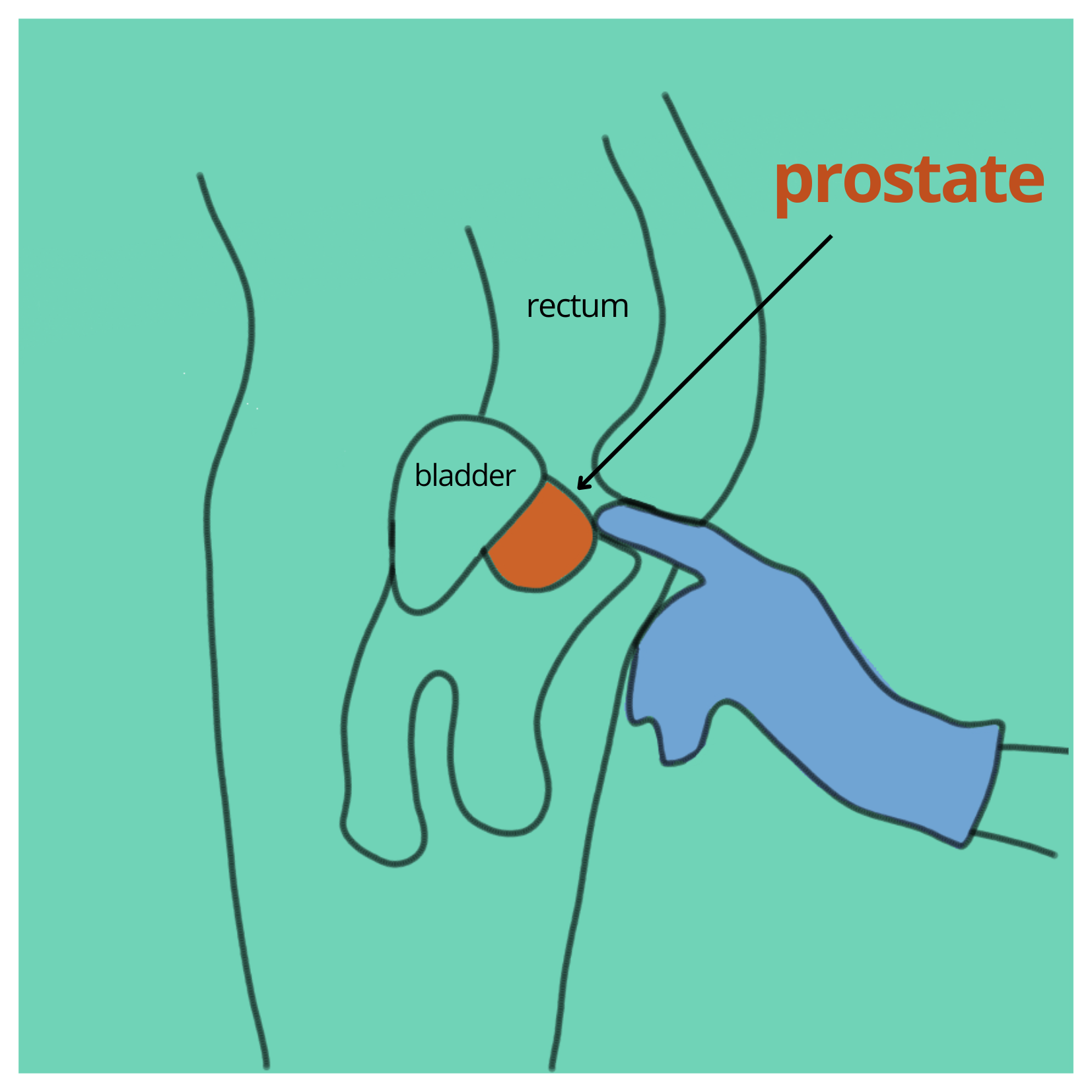 prostate